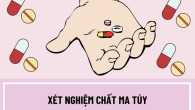  Xét nghiệm 4 chất gây nghiện có thể phát hiện ra những chất nào?