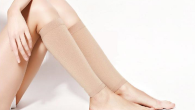 Cách điều trị bệnh suy giãn tĩnh mạch