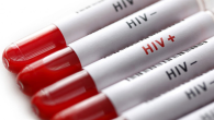 TEST NHANH HIV VÀ NHỮNG THÔNG TIN CẦN BIẾT