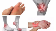 Cách phòng ngừa thoái hóa khớp