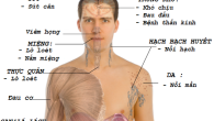 Những triệu chứng nghi ngờ bạn có thể nhiễm HIV