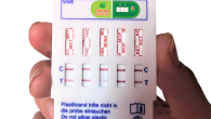 Những điều cần biết về xét nghiệm ma túy trong nước tiểu