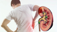 Đau hố thắt lưng kèm tiểu buốt, tiểu máu đề phòng sỏi thận, sỏi niệu quản