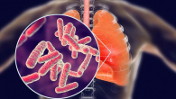 NGỪA NHIỄM TRÙNG CƠ HỘI Ở NGƯỜI MẮC HIV