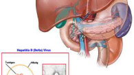 Virus viêm gan D (HDV)