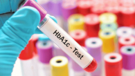 Hiểu Về HbA1c Để Kiểm Soát Tốt Hơn Bệnh Tiểu Đường