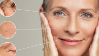 Thiếu collagen trong da có biểu hiện gì?