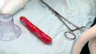 THỬ 'CẢM GIÁC LẠ', NAM THANH NIÊN BỊ KẸT CÂY XÚC XÍCH TRONG HẬU MÔN