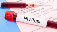TEST NHANH HIV VÀ NHỮNG THÔNG TIN CẦN BIẾT