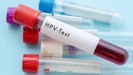 TEST HPV NHANH TẠI NHÀ CÓ CHÍNH XÁC KHÔNG?