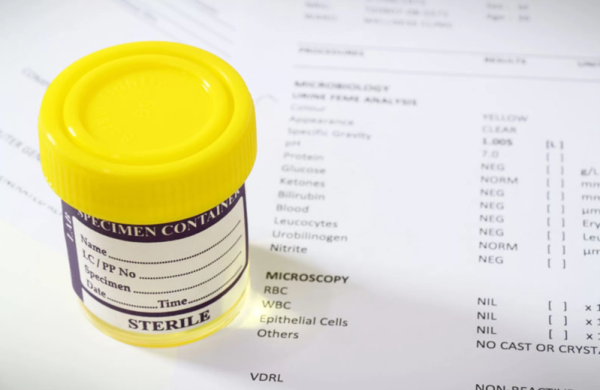 Cách đọc kết quả xét nghiệm nước tiểu cơ bản.