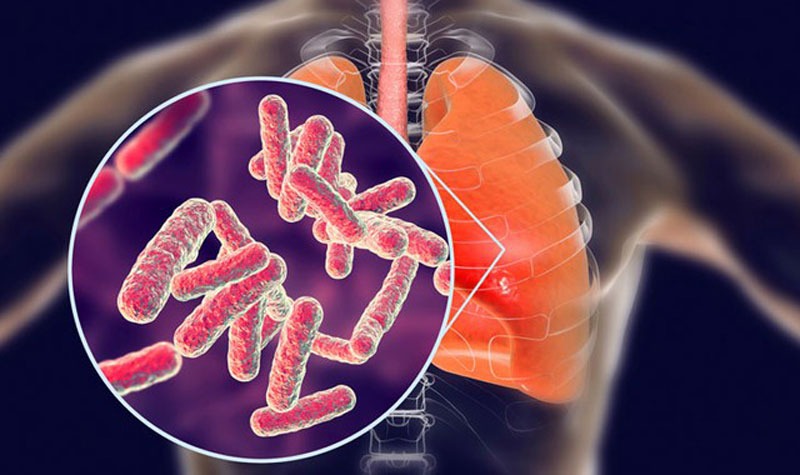 Bệnh nhiễm trùng cơ hội thường gặp ở người nhiễm HIV