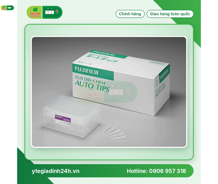 AUTO TIPS