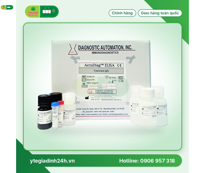 Test ELISA xét nghiệm giun đũa chó Toxocara IgG - CORTEZ
