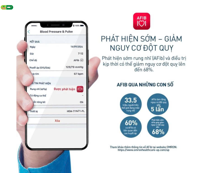 Máy đo huyết áp bắp tay Omron IQ BT Power Hem 7194T1 Flc Afib (dòng mới 2026)